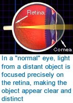 How The Eye Works