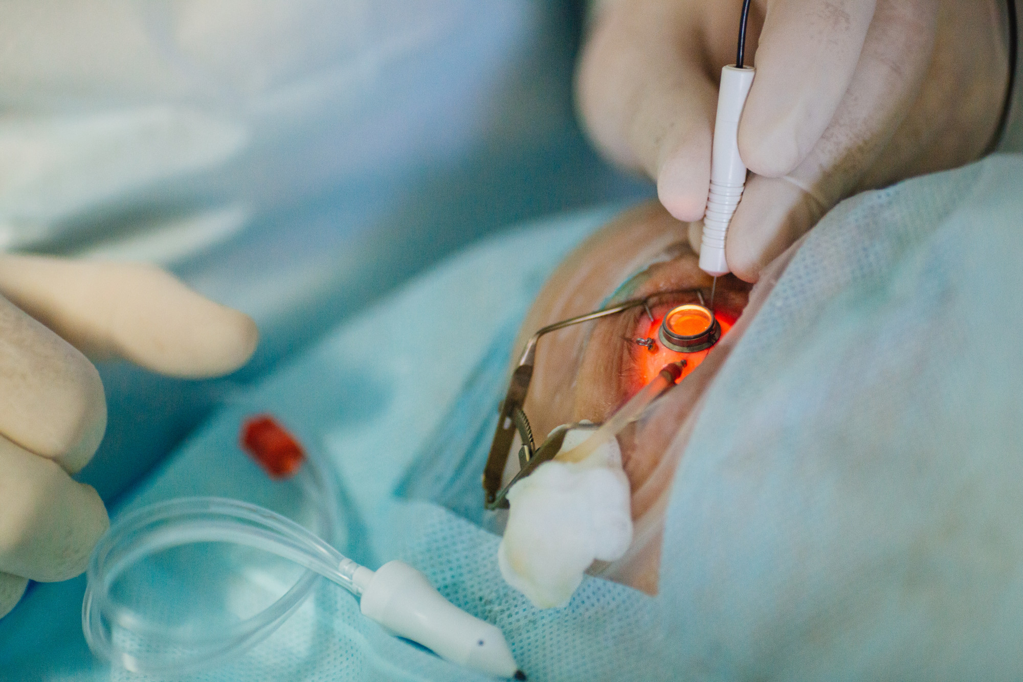 eye makeup after cataract surgery